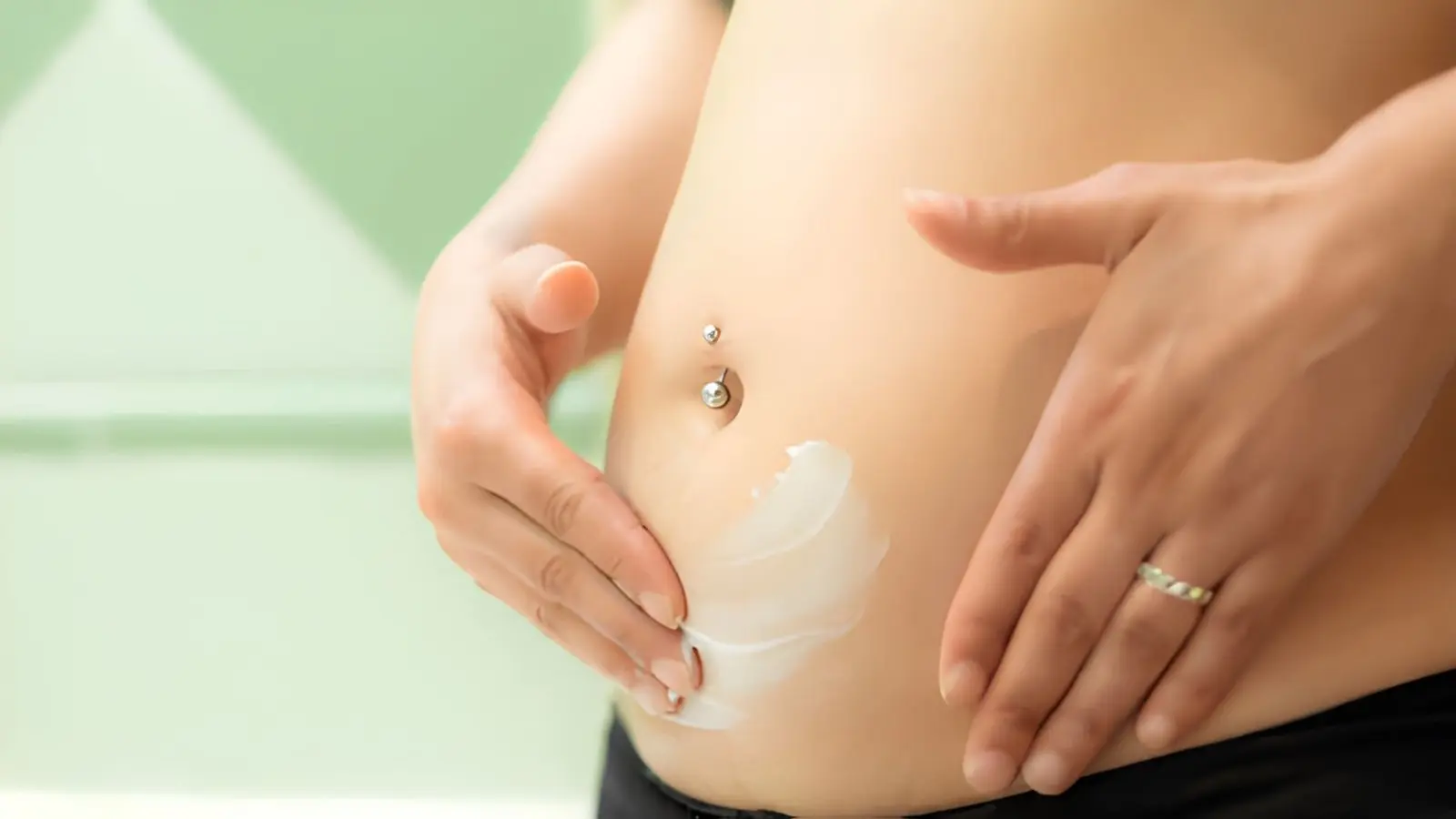 When Should You Start Using Ointment for Stretch Marks